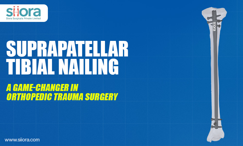 Suprapatellar Tibial Nailing